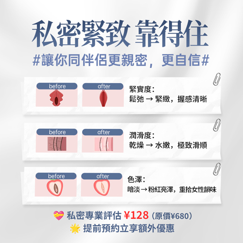 生完BB陰道鬆弛怎樣改善?八爪魚緊縮術助香港女性重拾私密緊緻